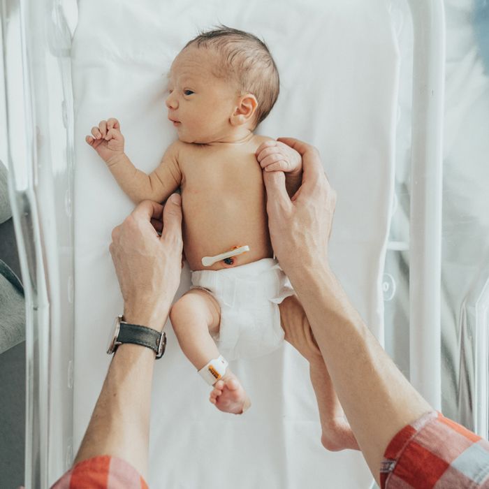Umbilical Cord Care: No, Don’t Pull It Off