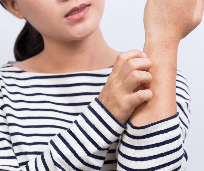 pregnant woman with Cholestasis itchy her arm