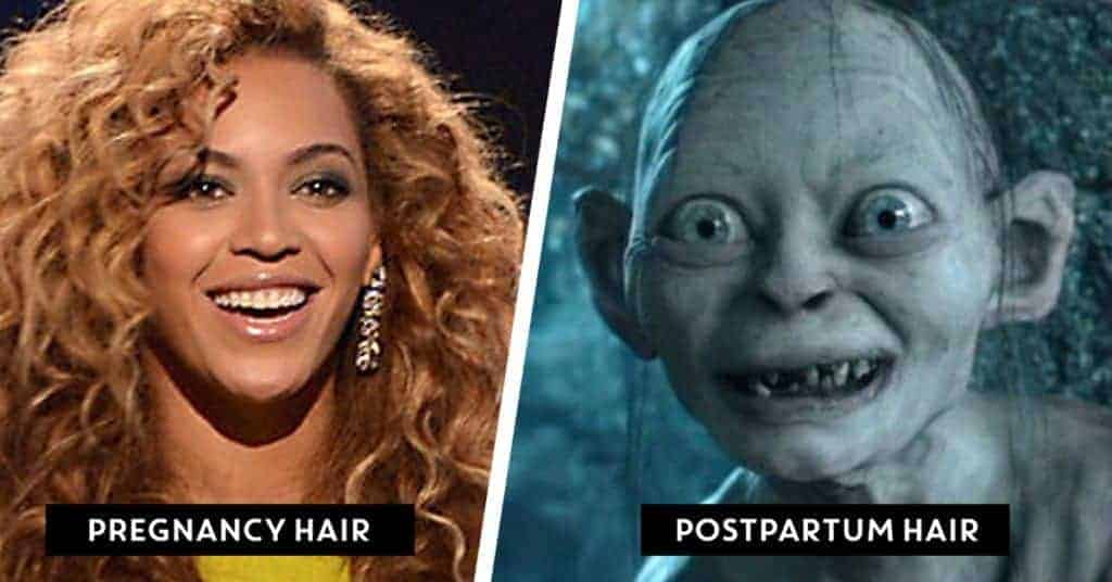 pregnancy hair vs postpartum hair loss. The Truth about Postpartum Hair Loss: Hair Today, Gone Tomorrow