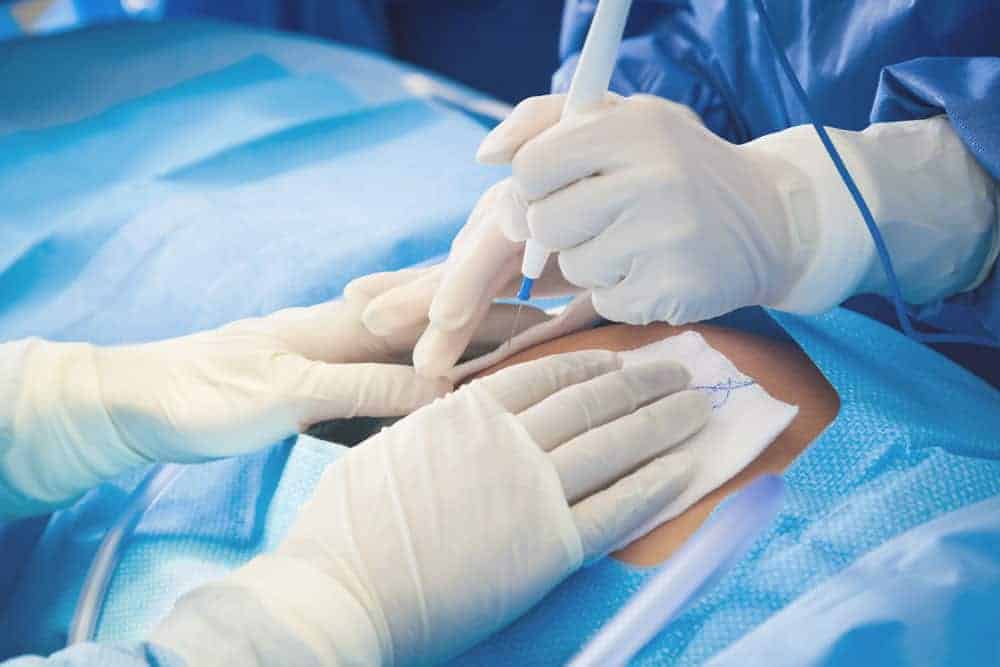 doctors making first incision for c-section (or Caesarean Section)